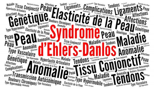 Syndrome d'Ehlers-Danlos